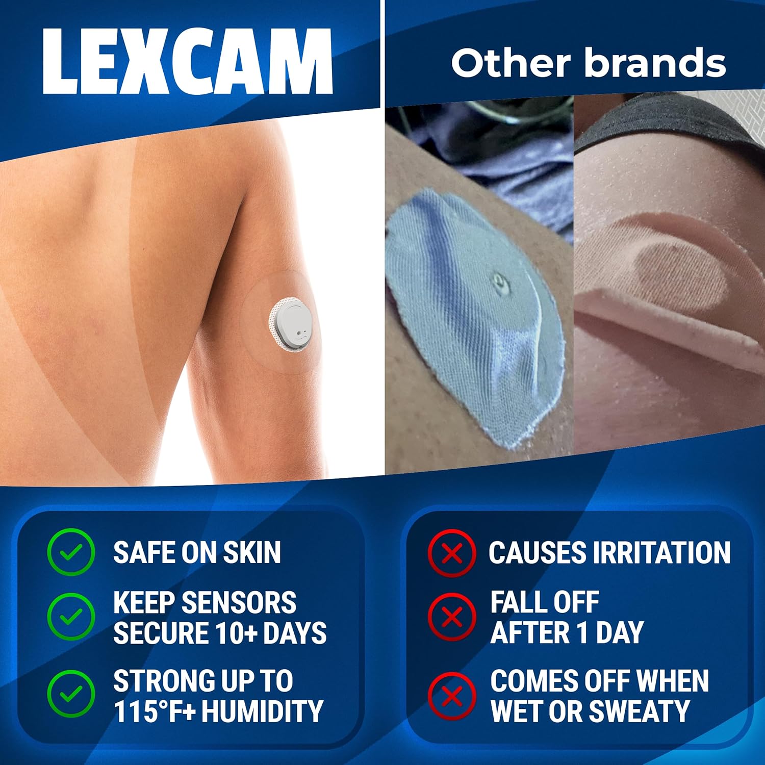 The CGM Adhesive Patch Buyer's Guide: Skin Grip, Lexcam, Onida, Ceeport, and More Compared